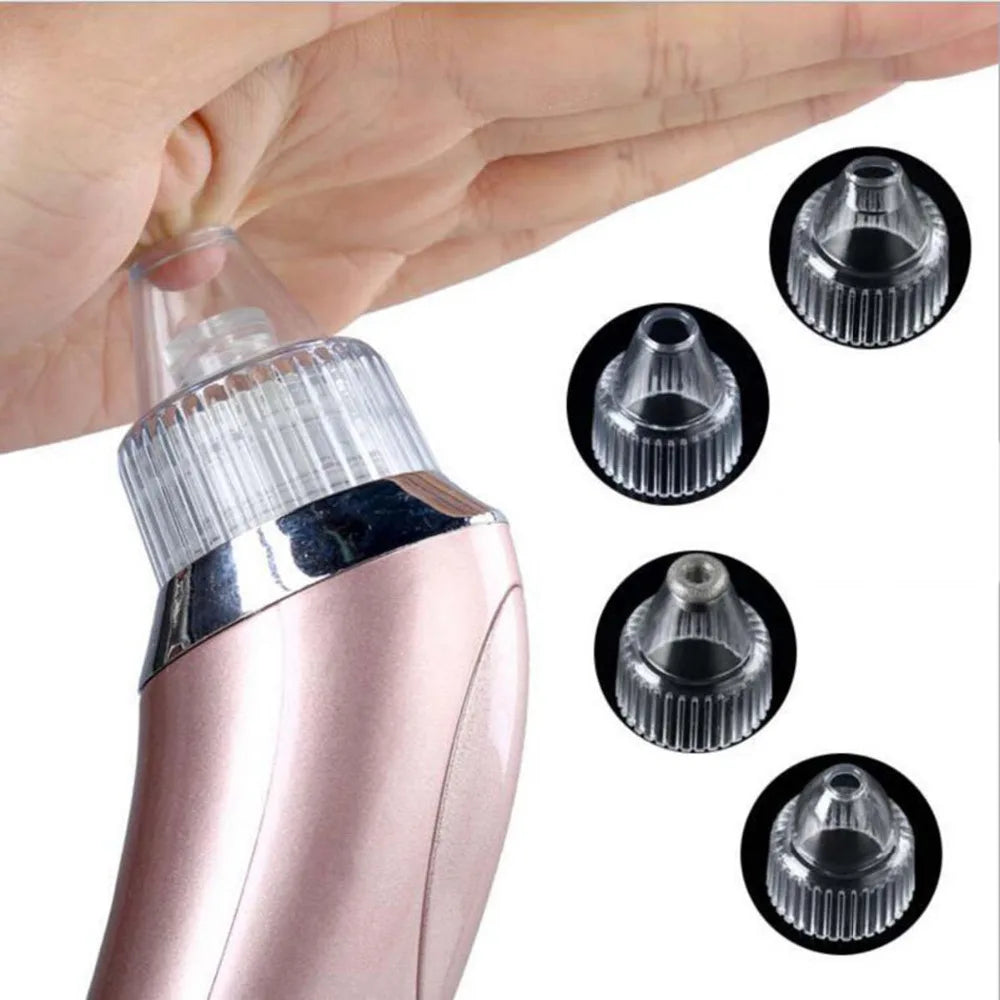 Electric Blackhead Extractor