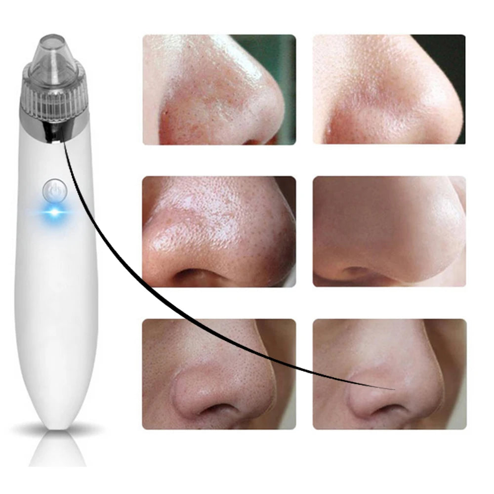 Electric Blackhead Extractor