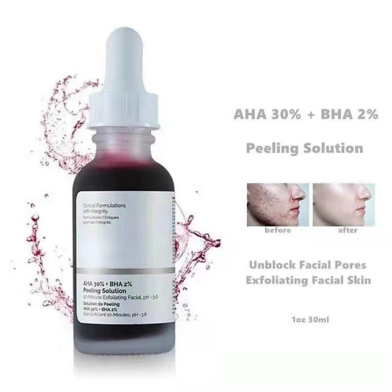 Sérum Exfoliant Réparateur – Anti-Acné & Points Noirs