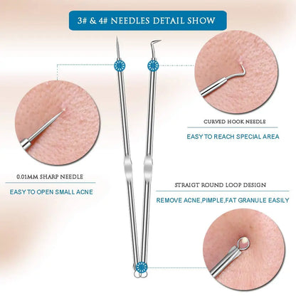 Set d'Aiguilles LunaGlow pour l'Extraction de l'Acné